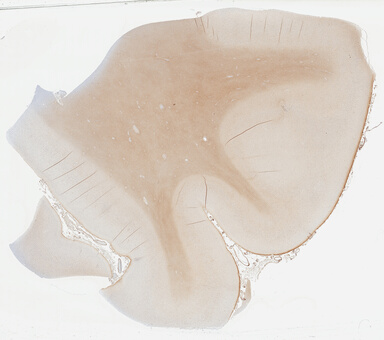 ['deident_e6cdfea5-ed1f-4539-9a4a-bf57f48f4f2c_695fc2d3.jpg']