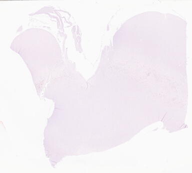 ['deident_3302675a-7d96-4bb8-adc6-84abff9edf1f_69d954bb.jpg']