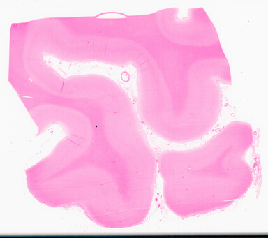 ['deident_826beaea-cdbe-407c-bdef-88b8fff6249e_69d954dd.jpg']