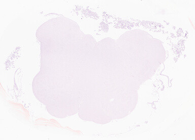 ['deident_15ba2b96-ab51-40b2-bb7a-59ad7fa287ce_69d954ac.jpg']