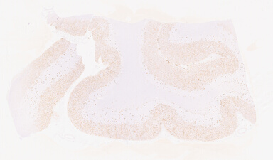 ['deident_f403dc9a-5b83-4d2f-9587-4a0cdfa6b27e_69d95516.jpg']