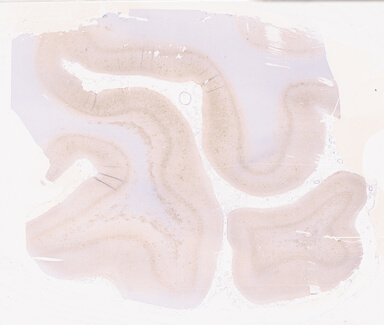 ['deident_da13f398-5628-449a-baf2-5c087c767728_69d9550f.jpg']