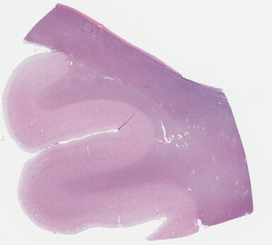 ['deident_1422effd-0dc1-4dd1-bff6-0e1d8f26bbe0_695fd02a.jpg']