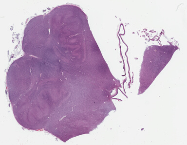 ['deident_f92b9350-89cb-4645-9ba3-4525d1a0c21e_69b038de.jpg']