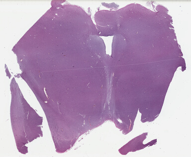 ['deident_6dbd5dac-79c2-44e7-b942-31dd3b52b091_69b038aa.jpg']
