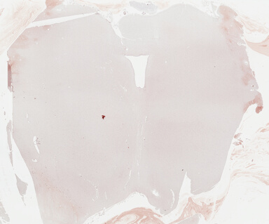 ['deident_02a7c13b-36e6-4c5f-8f64-6bb25b1b004a_69b03887.jpg']