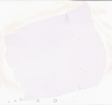 ['deident_55690a3d-1cbf-49cf-9c44-b0cf8756f744_69b02e1a.jpg']