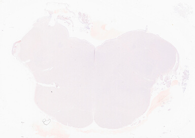 ['deident_6a064a11-9150-46ac-a42e-65ad98c13e8d_69b02e26.jpg']