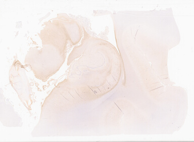['deident_fe8bb146-24aa-4cd3-b80b-b7e5da61d2f1_69b02e92.jpg']