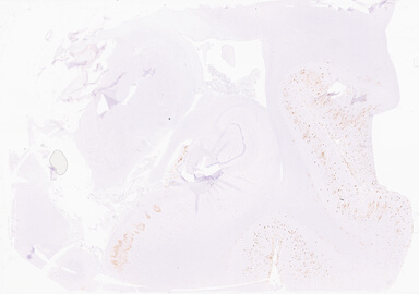 ['deident_bfe0b252-03c4-467b-8195-792b5b3162a8_69b02e6e.jpg']