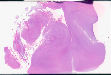 ['deident_22cafcac-16ce-457e-88d1-fab04102b4b2_69b02ded.jpg']