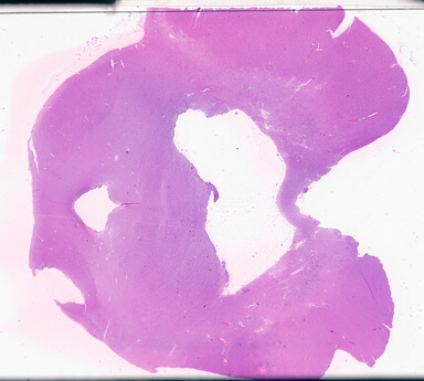 ['deident_a7fc3565-9023-4f0f-947a-5b86ca2b225e_69b02e62.jpg']