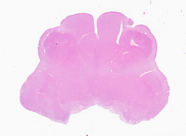 ['deident_15a8c23f-b69c-4779-b603-c7884846b2c3_69b05672.jpg']