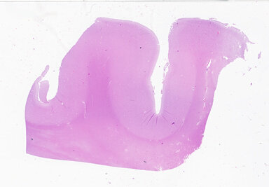 ['deident_281cdc0e-253e-4070-a01d-6dcf8fa24f95_69b0567c.jpg']