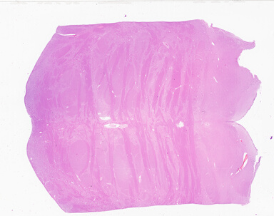 ['deident_94aa84d5-d770-4b90-b6b9-715589e418e3_69b0569e.jpg']