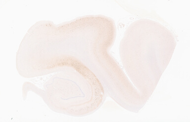 ['deident_2646d2f1-e005-4182-ade4-10fdde580b67_69b0567b.jpg']