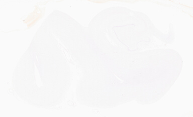 ['deident_1162a367-b35a-4bc4-96ca-4811678b32e5_69b0566d.jpg']