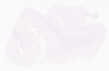 ['deident_fa04d88c-0fbb-4f48-9484-b3cfd31f9b5e_69b056c3.jpg']