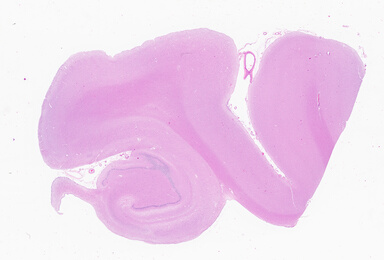 ['deident_a9197aec-bf5d-43dd-8213-c9610e26352d_69b056aa.jpg']