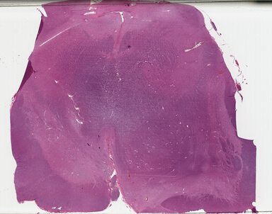 ['deident_329023ec-8a9f-43aa-90e9-6df30809aaff_695fc643.jpg']