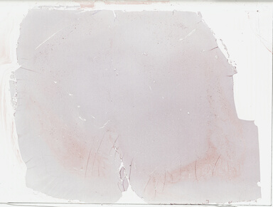 ['deident_11b2496a-e286-4dcb-b734-4c42c8255ffc_695fc63d.jpg']