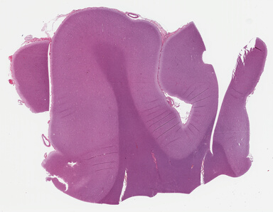 ['deident_425d43b6-b47f-4aea-8630-609d954392ac_695fc64c.jpg']