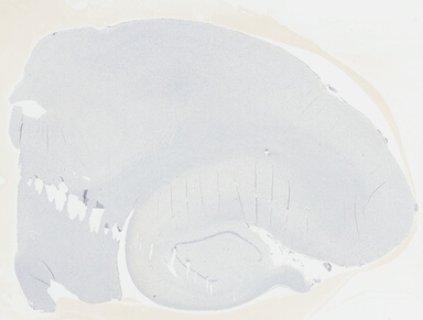 ['deident_9b5958d5-fe96-47db-baa4-bbf107941948_695fc672.jpg']