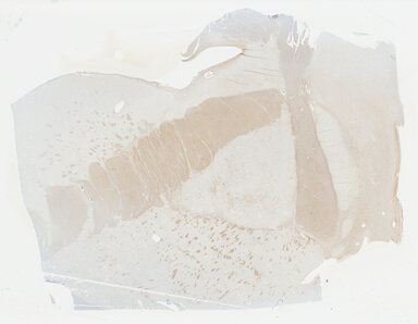 ['deident_a4de259c-5371-4578-9a7f-2cae34f159b1_695fc677.jpg']