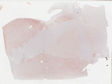 ['deident_c0b2f872-63b4-4ccf-935b-d45dfb716f7a_695fc686.jpg']