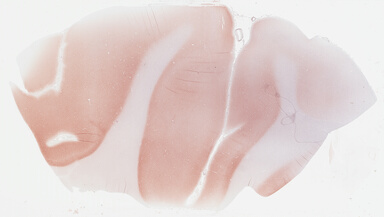 ['deident_7b0a95a3-5261-4ed5-b8e4-9ccd6499db0d_695fc65f.jpg']
