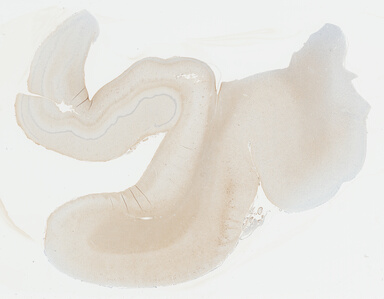 ['deident_de8e771e-3c6d-4c35-935e-315807c421c3_695fc696.jpg']