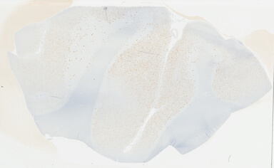 ['deident_fc82452d-e7ca-4a53-ad74-86bad5a3da69_695fc69f.jpg']