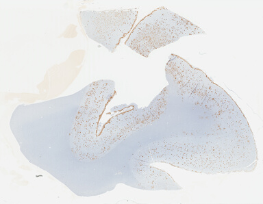 ['deident_42ce18d4-f15b-4fdf-bd21-f52a9d840f88_695fc64d.jpg']