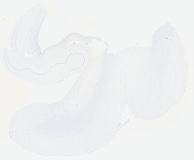 ['deident_68c0c5da-fbf6-485a-b8cd-2b1f3e5e7732_695fc658.jpg']