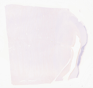 ['deident_a0a6019b-9299-4287-aeb3-f687a3d0f5e9_695fc673.jpg']