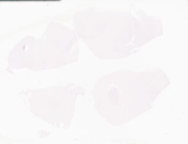 ['deident_040157ae-4861-4fdd-832c-a7e8859f0ec7_69d96a15.jpg']