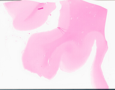 ['deident_b70a687c-2dae-452f-ade2-5f8dff5438f2_69d96a73.jpg']