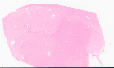 ['deident_e78fc0e0-e021-4499-80c3-1094c483624a_69d96a84.jpg']
