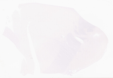 ['deident_025860f0-59ab-489b-a00b-93af63fc5f7e_69d96a12.jpg']