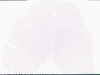 ['deident_515d6183-06e3-41d1-a3fe-5d78127f7a58_69d96a41.jpg']