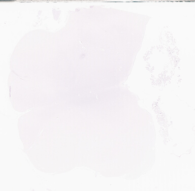 ['deident_812d8cc8-ed07-4eb3-9b3a-5c16529852dc_69d96a57.jpg']