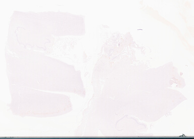 ['deident_86621a3c-8426-428d-81d4-40030d3d1a3d_69d96a5c.jpg']