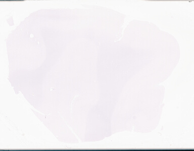 ['deident_b04a585f-c398-495c-b5f3-551c513dd5e2_69d96a70.jpg']