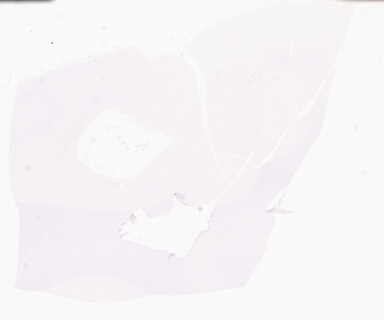 ['deident_ef3217e5-0f07-4bbc-8b8a-8ad34a25b504_69d96a8c.jpg']
