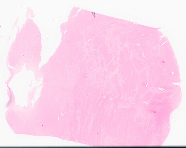 ['deident_e07e0c2a-8228-4c9c-85db-036c7b172d5c_69d96a7e.jpg']