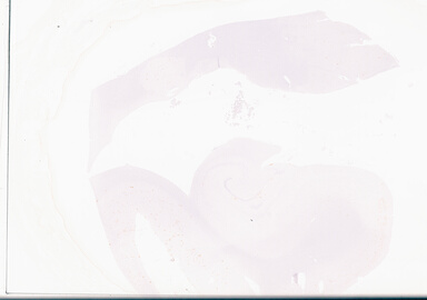 ['deident_62d14f54-f97b-481d-9ba6-6129a1bc304f_69d96a4c.jpg']