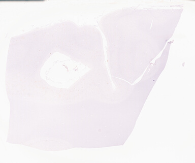 ['deident_5e99a11a-09e0-4d43-b3bd-447faf479e52_69d96a4a.jpg']