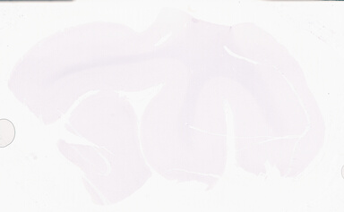 ['deident_fe0e32a9-55e5-404e-ae9a-24692ceb26d4_69d96a92.jpg']