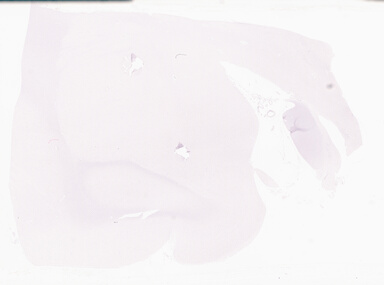 ['deident_cf8f7f95-e73e-422d-b782-813eca959995_69d96a78.jpg']