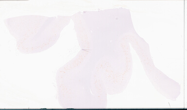 ['deident_ea294fdf-562c-424a-b8be-6db50408a6f8_69d96a85.jpg']